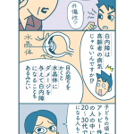 【漫画付き】アトピー性皮膚炎の人は白内障になりやすい!? これってホント？
