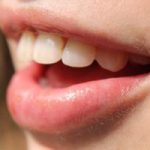 早めに治療を受けよう！噛み合わせ治療の流れと種類