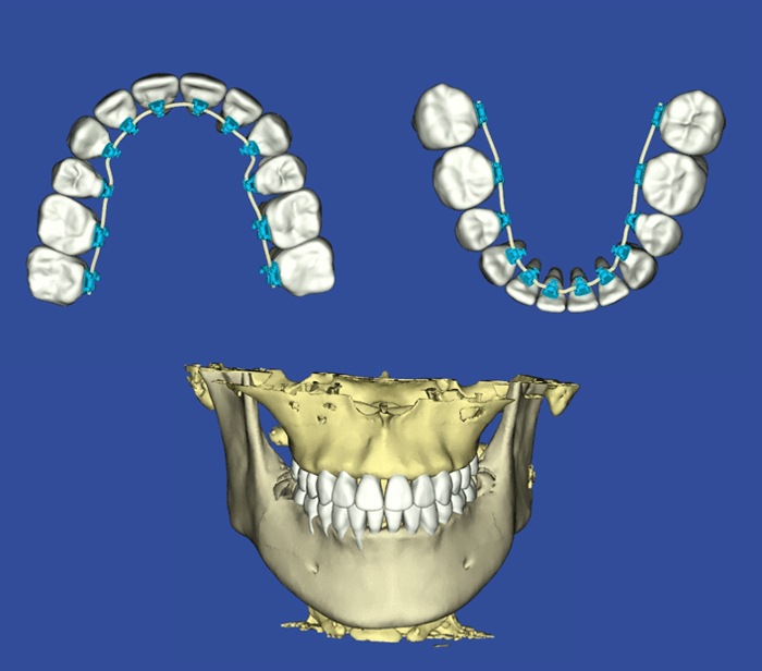 ヴァーチャル・ペイシェント
