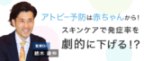 非公開: アトピー予防は赤ちゃんから！ “生まれてすぐ”のスキンケアが発症率を劇的に下げる!?